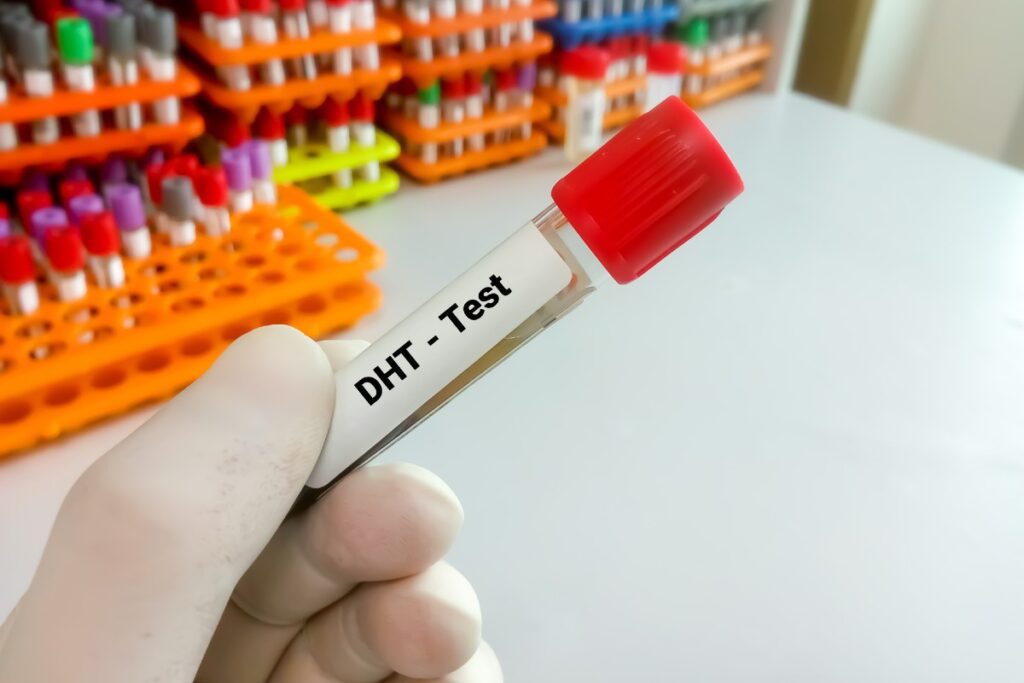 Ein DHT-Teströhrchen im Labor