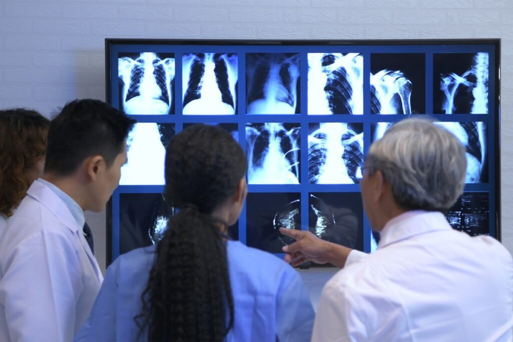 Eine Gruppe Ärzte vor Röntgenbildern