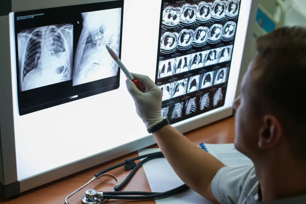 Arzt Röntgenbild COPD