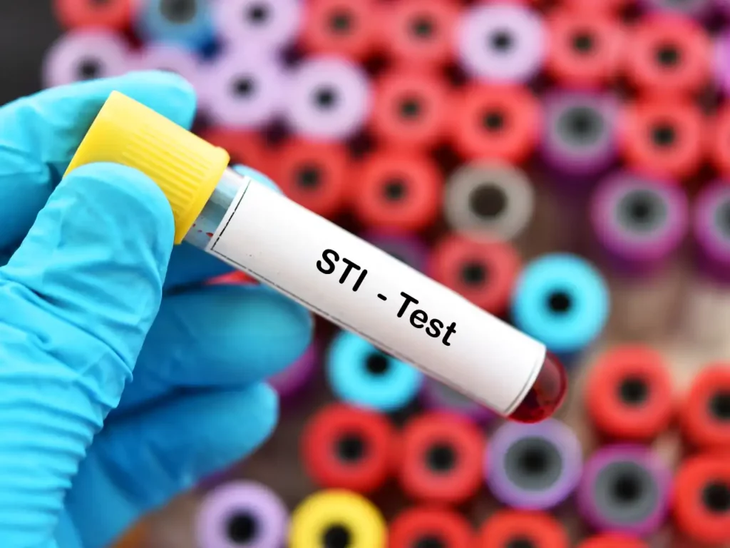 Test Ampulle STI