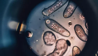 Parasiten Unter Mikroskop