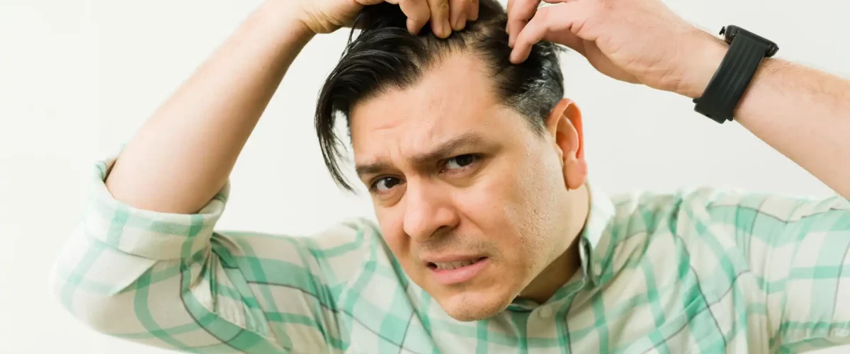 Junger Mann Haarausfall