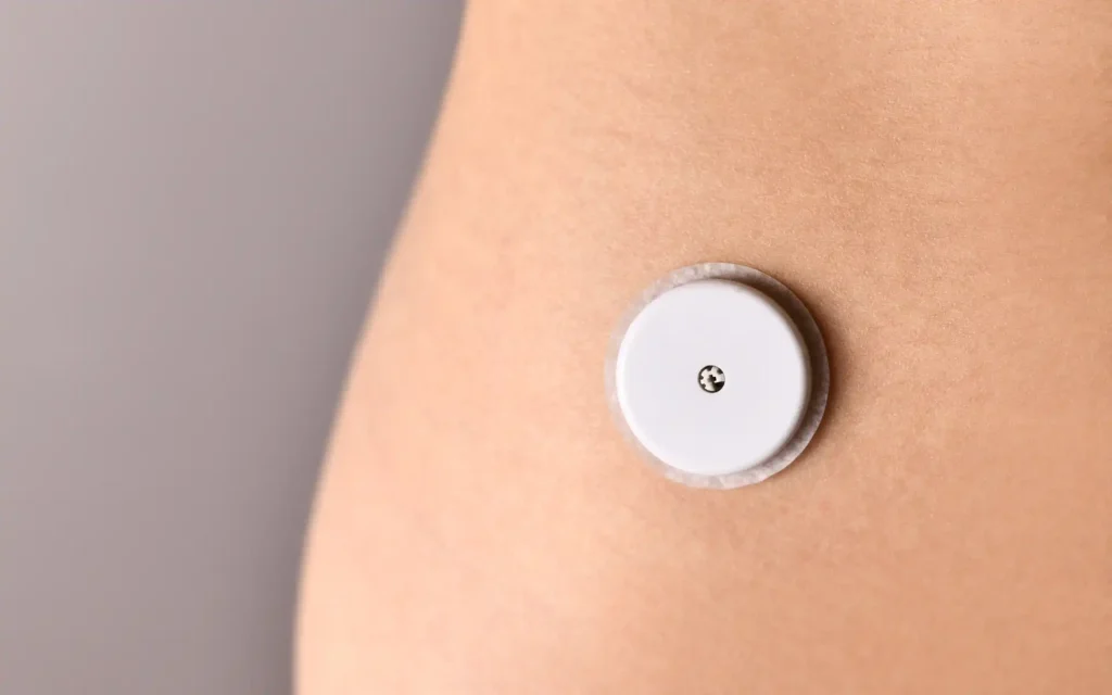 Ein Glukose-Sensor in Nahaufnahme am Arm