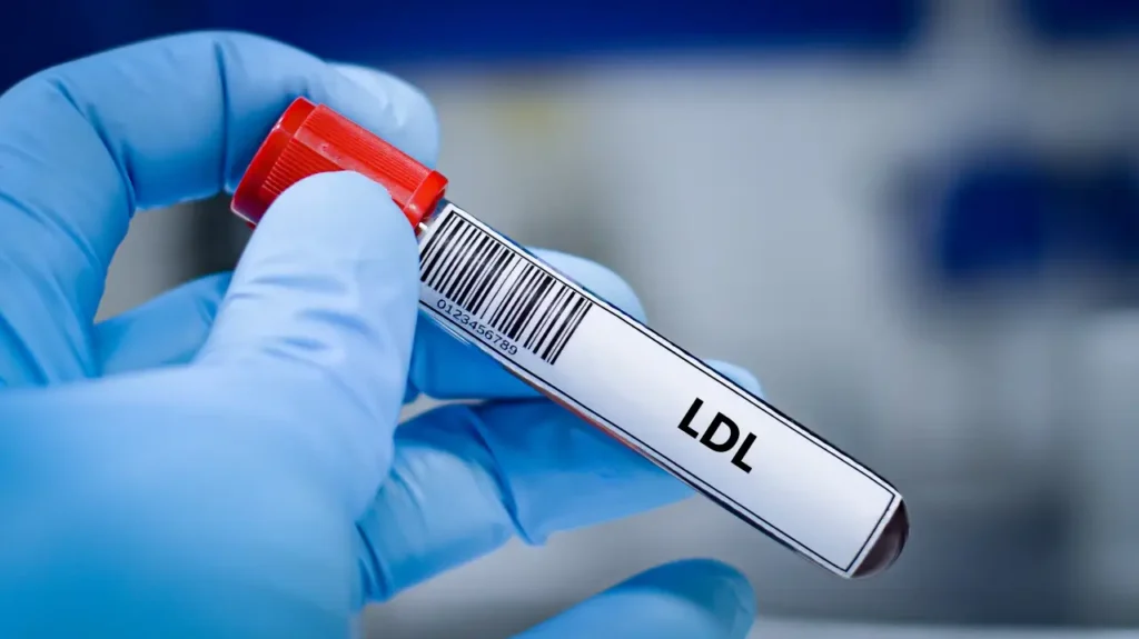 Röhrchen mit Blut und der Aufschrift LDL
