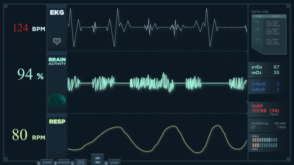 Animation einer Anzeige zur schnellen Auswertung eines Elektrokardiogramms