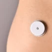 Ein Glukose-Sensor in Nahaufnahme am Arm