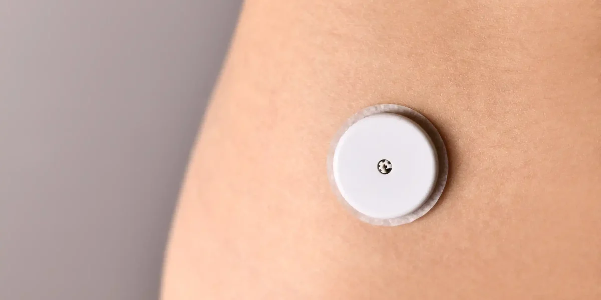 Ein Glukose-Sensor in Nahaufnahme am Arm