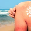 Frau am Strand mit Sonnensymbol aus Sonnencreme auf der Schulter