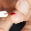 Frau nimmt Blutzuckermessung vor