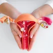 Modell Gebärmutter Endometriose