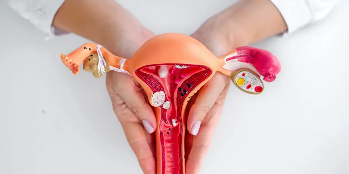 Modell Gebärmutter Endometriose