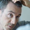 Mann, der seinen Haaransatz vor dem Spiegel untersucht