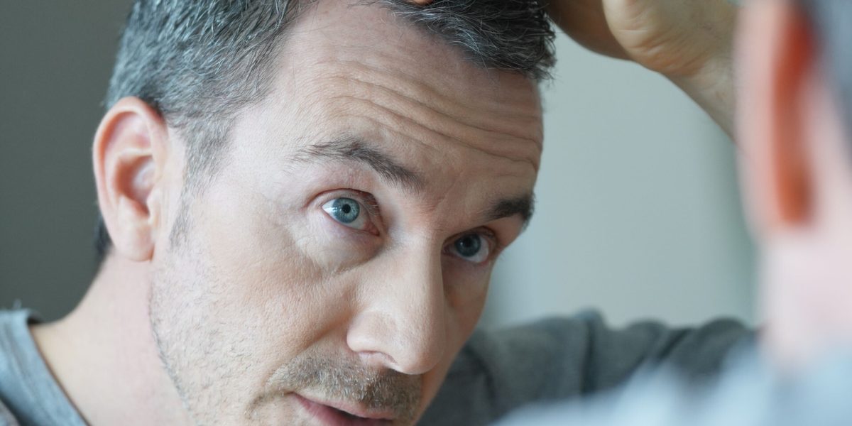 Mann, der seinen Haaransatz vor dem Spiegel untersucht