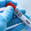 Test dépistage prostate